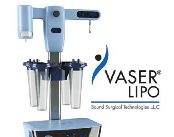 Máy hút mỡ Vaser Lipo